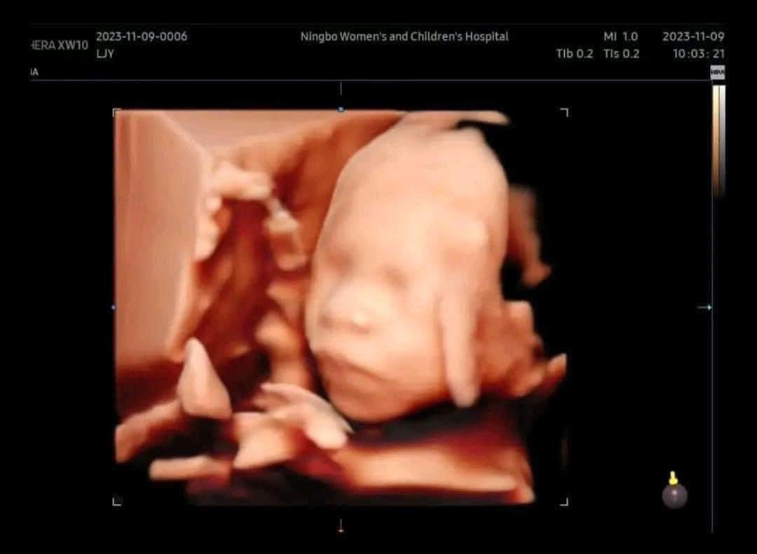 aemeruls_'s tweet photo. Ini adalah cara macam mana nak check anak ikut buka ibu atau ayah https://t.co/5fbvL0d7NU