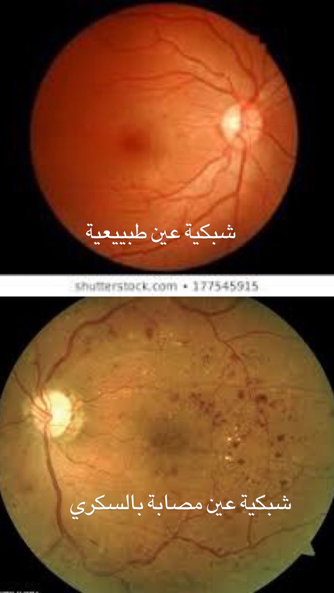Bdoors94's tweet photo. #ظلم_توظيف_تخصص_البصريات https://t.co/6fbQD8ikni