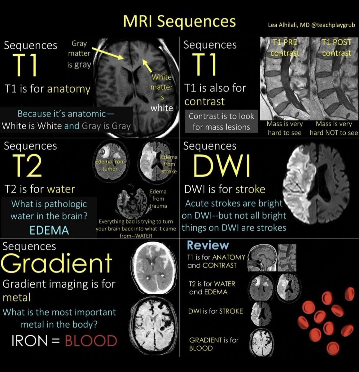 obmh_'s tweet photo. نصائح رئيسية للسيكونس في الرنين المغناطيسي  
Main MRI Sequences Tips🧲
#MRI #Radiology https://t.co/7GOAz2gPXS