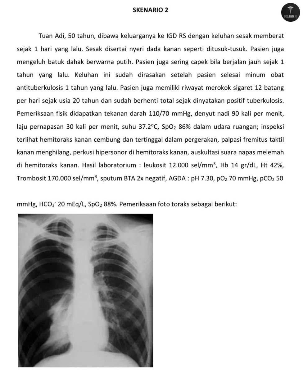 Dok ini pneumothorax krn tb ya ? Soalnya perkusi hipersonor. Atau pleuritis ya dok, mohon bantuannya dok