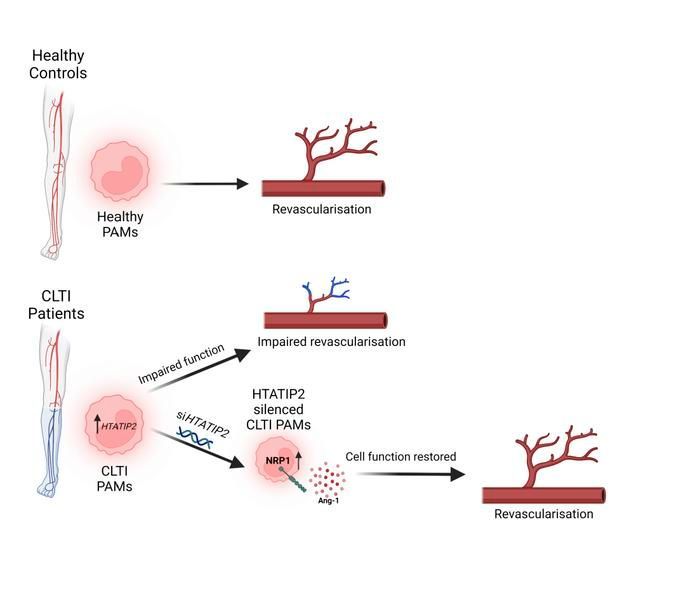 HTATIP2 regulates arteriogenic activity in monocytes from patients with limb ischemia: buff.ly/3NEZQwy 
@b_modarai @KingsCollegeLon 
#Angiogenesis #Therapeutics