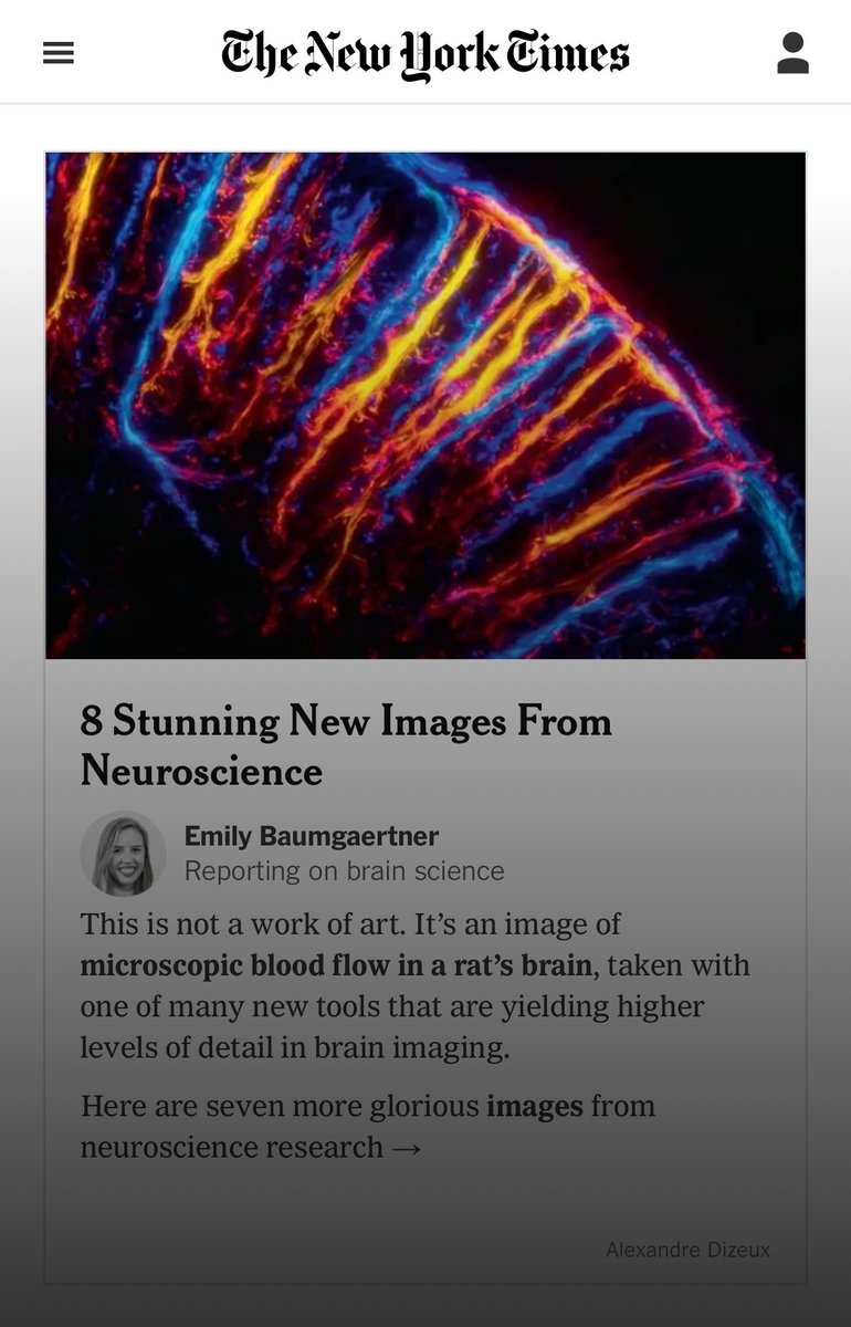 Real Christmas gift ! Ultrasound Localization Microscopy image of Brain vessels by our team @AlexandreDizeux @PhysMedParis @CharlieDemene @PezetSophie N. Renaudin with @Iconeus @inserm @psl_univ @ESPCI_Paris chosen by @NYTScience @nytimes as 2023 Stunning New Image of the brain