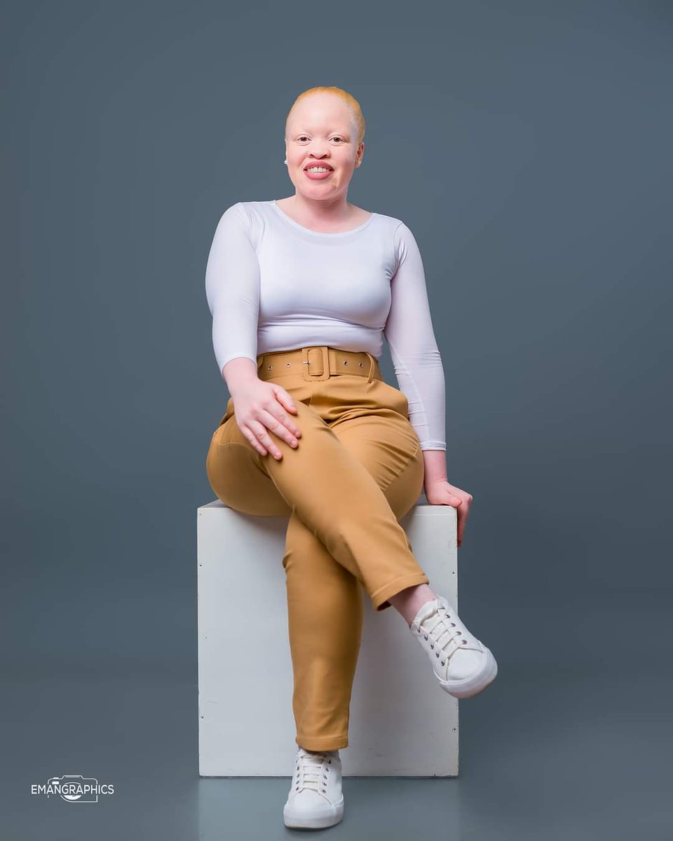 Thandiwe is beautiful, Reposts only if you agree.

#AlbinismKonect
#AlbinismKonectBand
#ImbelekoLoading