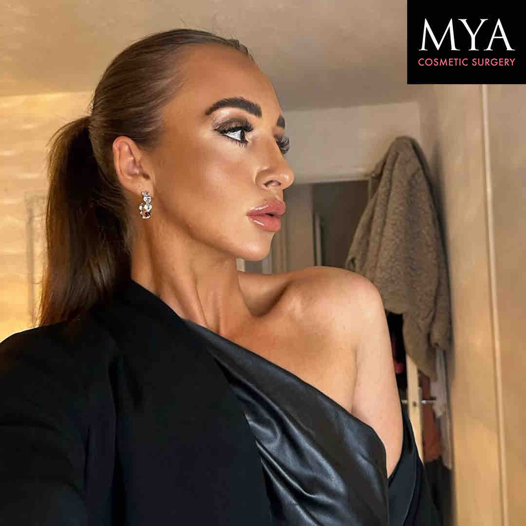 MYA_Tweet's tweet photo. The side profile of dreams 😍💗

Book your FREE Rhinoplasty consultation at https://t.co/dYksJBtpFI #rhinoplasty #myagirl #myacosmeticsurgery #cosmetic https://t.co/jt7aOFV4RV