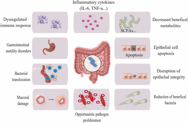 d2a8h's tweet image. 🚨#في_الطوارى و #العناية_المركزة
🔸 يمر علينا بشكل يومي مرضى يعانو من sepsis / septicemia " تسمم الدم🩸"
-تسمم الدم ممكن يؤثر بشكل سلبي على البكتريا في الأمعاء والمناعة والكتلة العضلية
🔻ورقة علمية حديثة ٢٠٢٣ مفيدة جداً للأطباء والمختصين 😍👌🏻
⬇️
sciencedirect.com/science/articl…