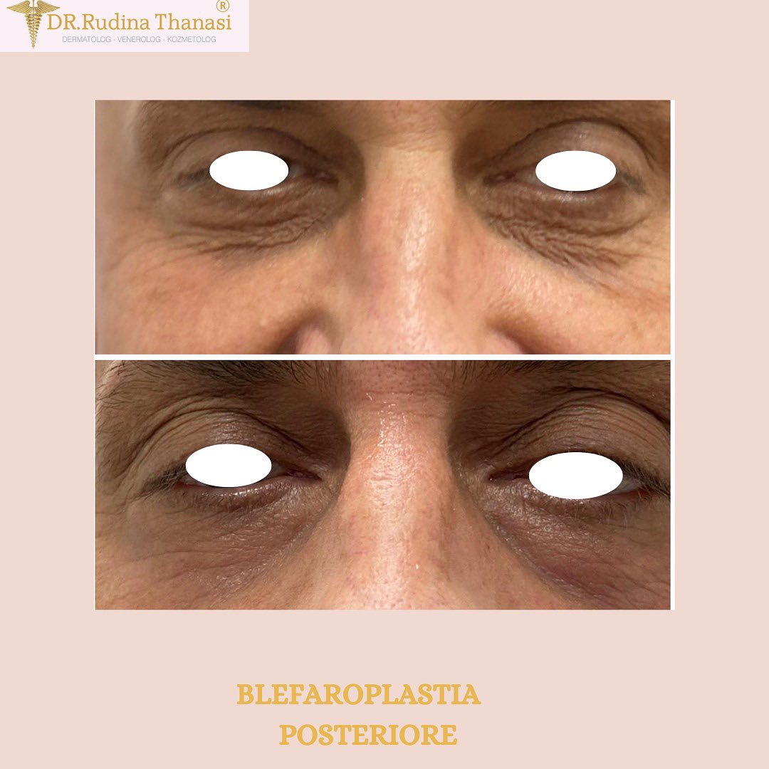 Ahead Creative - Marketing Agency Tirana tweet media