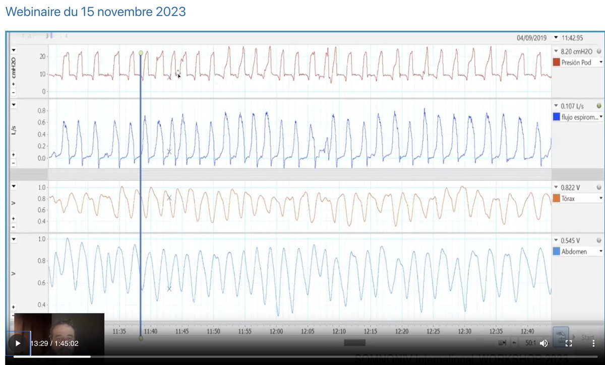 Nice first webinar for difficult traces with the SOMNONIV group, congratulations to the experts who found all the causes! not so obvious...do no be depressed...it was expert level...splf.fr/somnovni/