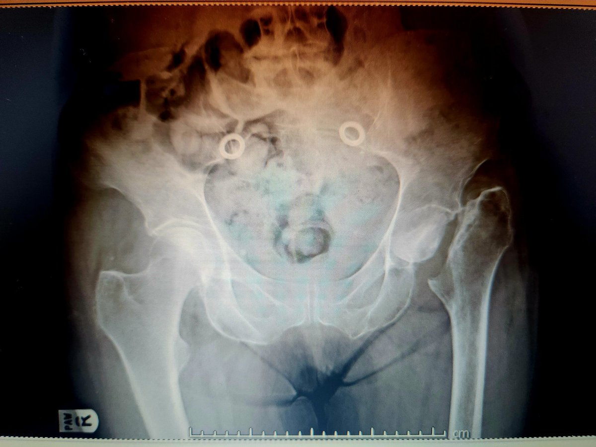 Deepu Bhaskar tweet media