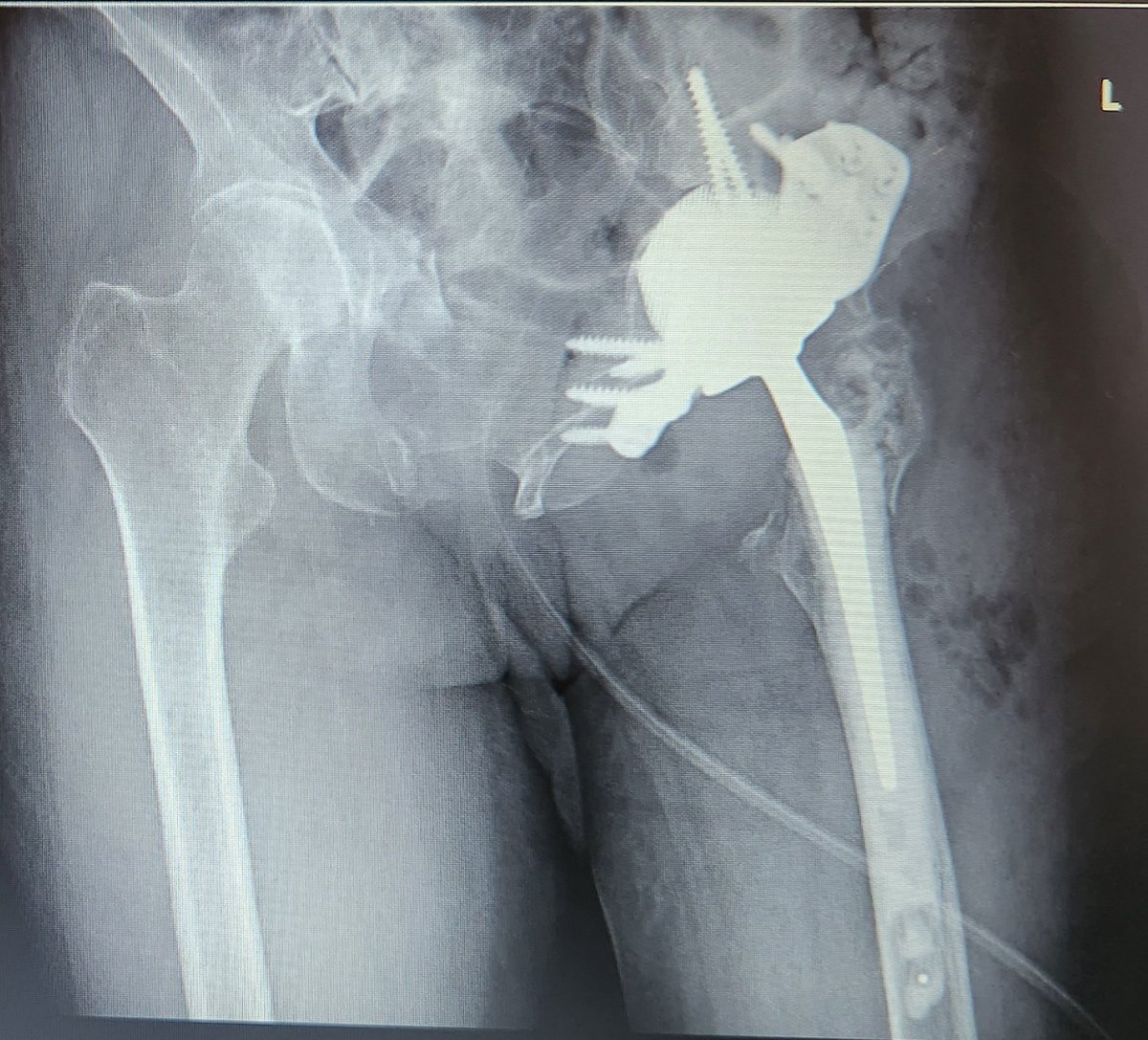 Deepu Bhaskar tweet media