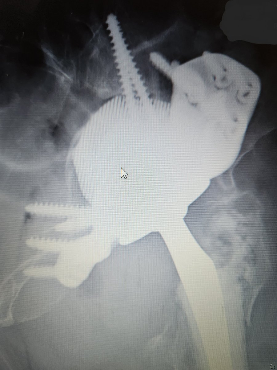 Deepu Bhaskar tweet media