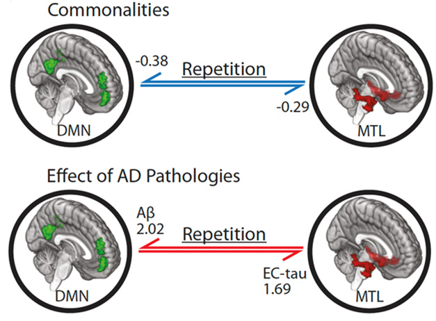 Alzforum (@alzforum) on Twitter photo A kicks neural circuitry into overdrive, coaxing tau entanglement from afar. <a href="/UCBerkeleyNeuro/">Berkeley Neuroscience</a> <a href="/UON_research/">Uni Newcastle Research</a> ow.ly/AqA050QlWw7 A kicks neural circuitry into overdrive, coaxing tau entanglement from afar. <a href="/UCBerkeleyNeuro/">Berkeley Neuroscience</a> <a href="/UON_research/">Uni Newcastle Research</a> ow.ly/AqA050QlWw7