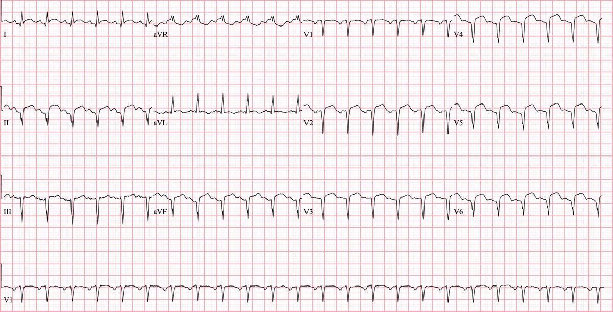 Sam Ghali, M.D. tweet media