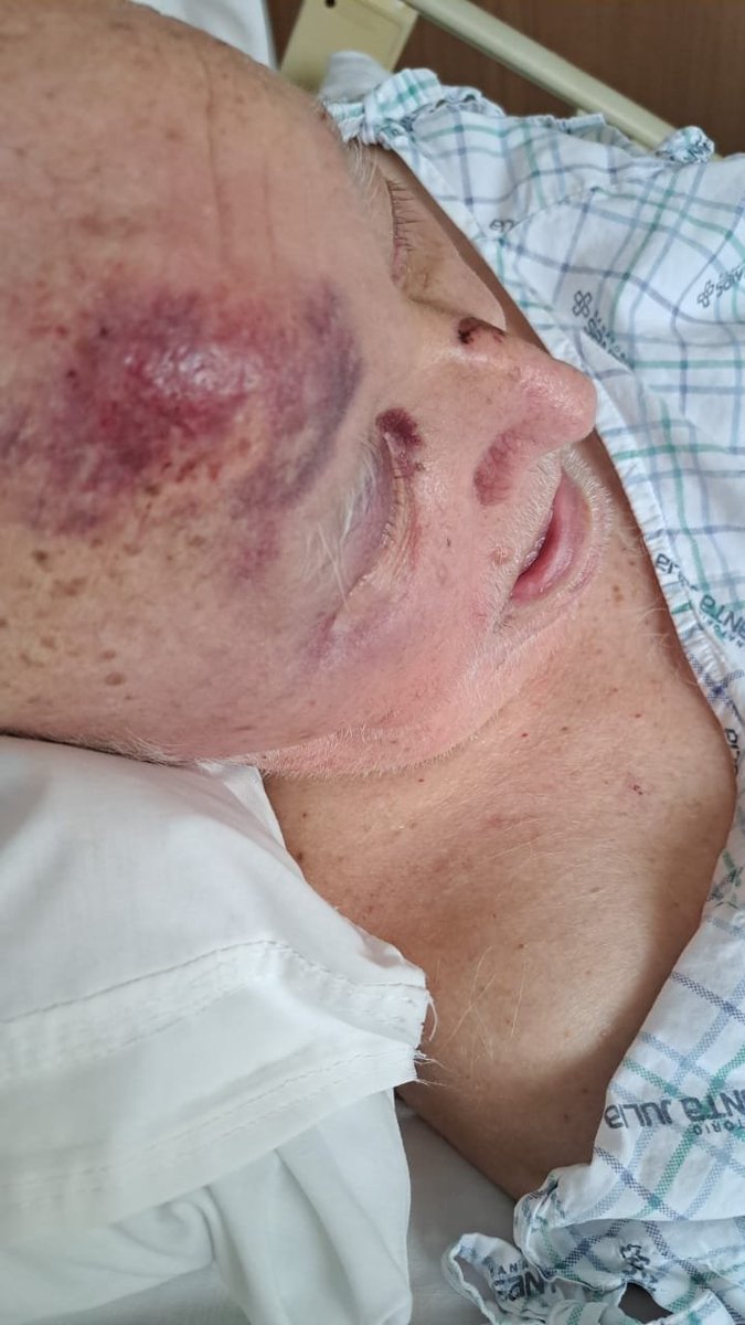 Es muy triste para mí, tener que compartir esto. Abro hilo, de como la empresa de AMBULANCIAS SASA S.R.L le echa a mi papá durante un traslado al Sanatorio Santa Julia 😭