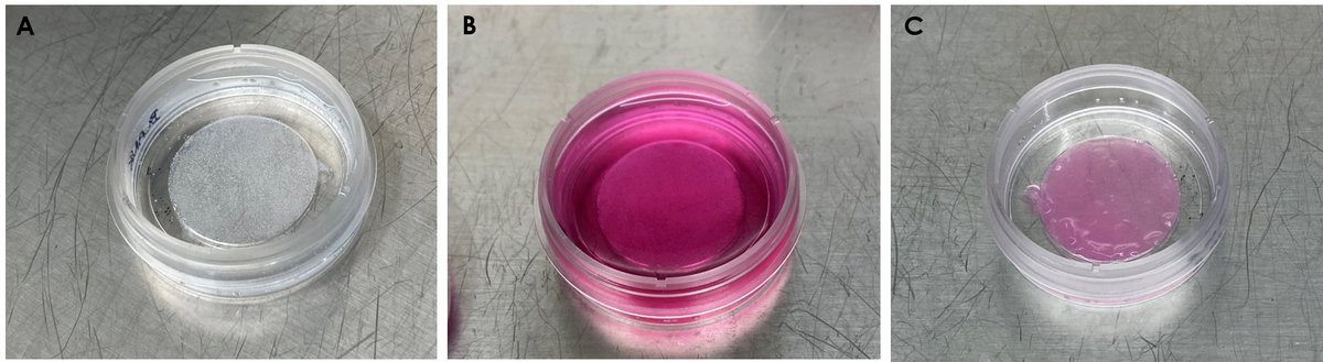 josbaema's tweet image. 🧬3D printing of Fibercoll-FlexA® scaffolds for the culture of fibroblasts @REGEMAT3D

labmethods.org/2023/12/19/3d-…

#bioprinting #labmethods