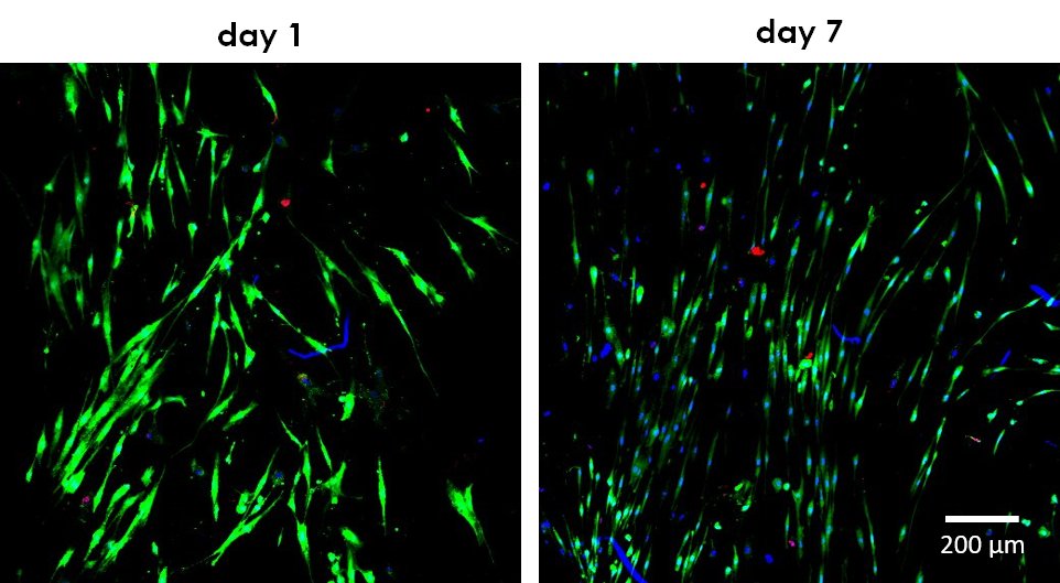 josbaema's tweet image. 🧬3D printing of Fibercoll-FlexA® scaffolds for the culture of fibroblasts @REGEMAT3D

labmethods.org/2023/12/19/3d-…

#bioprinting #labmethods