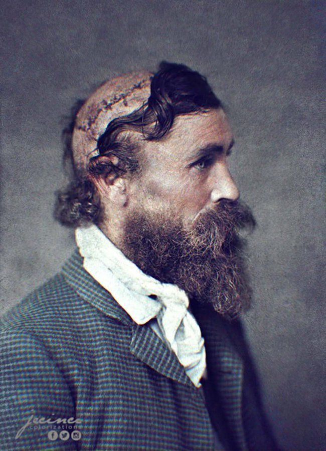 fasc1nate's tweet photo. In 1864, Robert McGee delivered supplies to an American army fort but was attacked by Native American warriors who scalped him. Unbelievably, McGee managed to survive the ordeal and lived to recount his nightmarish story. https://t.co/XI5IeqdjWn