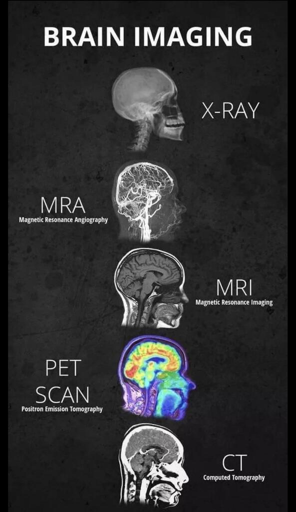 cristian_curro's tweet photo. A cool guide to scans 
#coolguides
 
#scanningtips #documentmanagement #digitaltransformation #scanningtechnology https://t.co/QDsLJixrIs