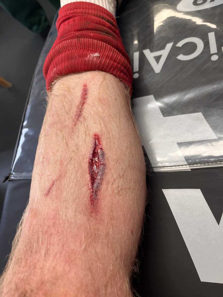 Ross Fallens tweet media