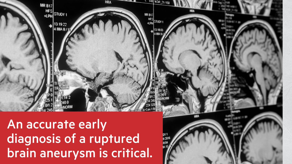 Brain Aneurysm Foundation tweet media