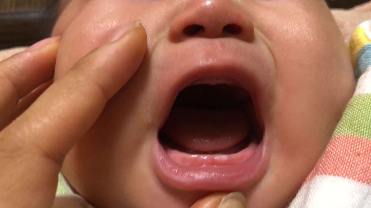 sunflowermackey's tweet photo. #2023jul_baby
#男の子ベビー
#5m16d(ポストは翌日)
#こんにち歯🦷 https://t.co/q7C1K4OK4T