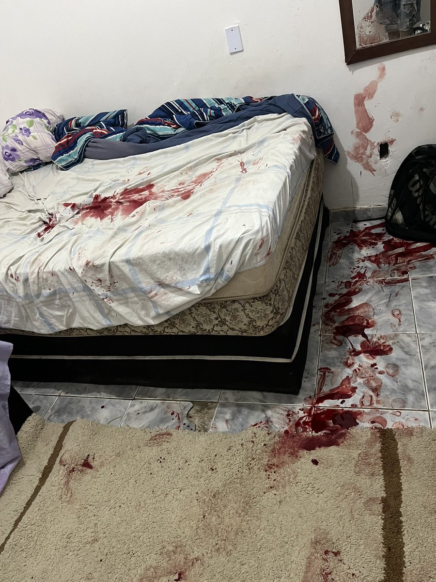 DaSul5521's tweet photo. Natal 25/23 sofri uma tentativa de homicídio de um cara que se dizia meu amigo, na manha do dia 25 enquanto eu estava dormindo ele pulou o muro da minha residência e me esfaqueou enquanto eu estava dormindo, numa atitude covarde levei 10 facadas!!! https://t.co/trZeeGLI2g