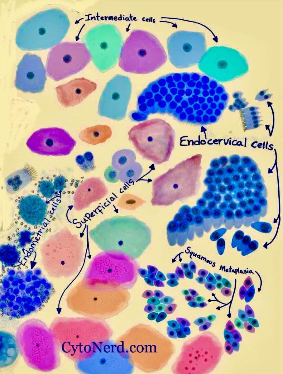 Felipe Templo Jr. 🕊 (@thejourneymate) on Twitter photo Paps Smear in Pictures 🔬 Paps Smear in Pictures 🔬