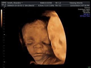 PsychDrSSmith's tweet photo. My baby girl Aubrielle Catherine Due 14 of March, 2024.I’m a bit over 7 months.Our fam espesh my 13yr old girl are very excited to meet her!We are so in💗 &amp;planning on sending 1 of these in to get an 8k pic to predict what baby girl will look like @ birth! Looks like dad&amp;bigSis! https://t.co/GqtJBN1y1i