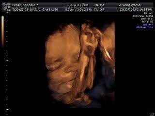 PsychDrSSmith's tweet photo. My baby girl Aubrielle Catherine Due 14 of March, 2024.I’m a bit over 7 months.Our fam espesh my 13yr old girl are very excited to meet her!We are so in💗 &amp;planning on sending 1 of these in to get an 8k pic to predict what baby girl will look like @ birth! Looks like dad&amp;bigSis! https://t.co/GqtJBN1y1i