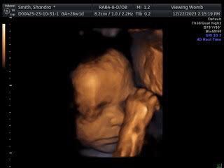 PsychDrSSmith's tweet photo. My baby girl Aubrielle Catherine Due 14 of March, 2024.I’m a bit over 7 months.Our fam espesh my 13yr old girl are very excited to meet her!We are so in💗 &amp;planning on sending 1 of these in to get an 8k pic to predict what baby girl will look like @ birth! Looks like dad&amp;bigSis! https://t.co/GqtJBN1y1i