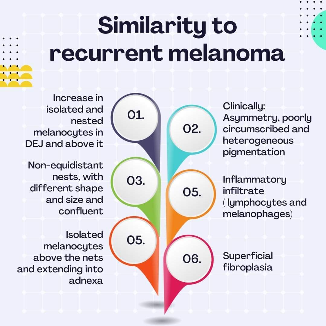 GeronimoJrLapac's tweet photo. Recurrent Nevus - A Melanoma Mimic! 😲

#pathplus #pathology #dermpath https://t.co/QrCTu9pTYl