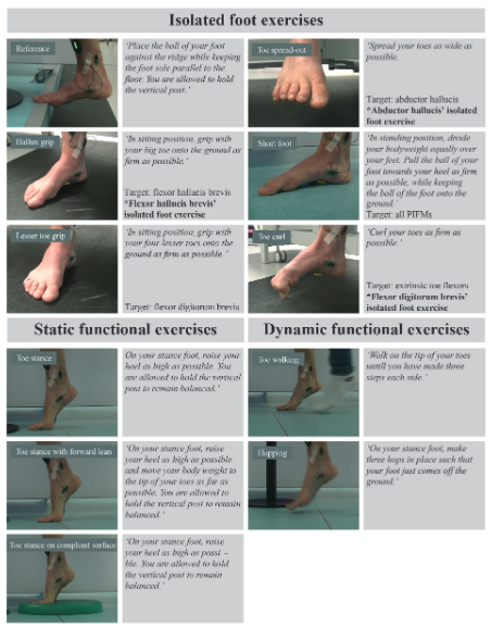 drchrisnorris's tweet image. Nice open source article on intrinsic muscle actions of the foot #footfunction #exercise #barefoot #martialarts #dance #CPD #sportstherapy #physiotherapy tandfonline.com/doi/epdf/10.10…