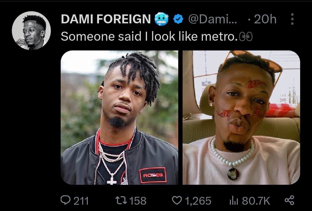 With those big lips en rare nose thing ...i think u told urself that sentence big mn..#coolest drip Nation