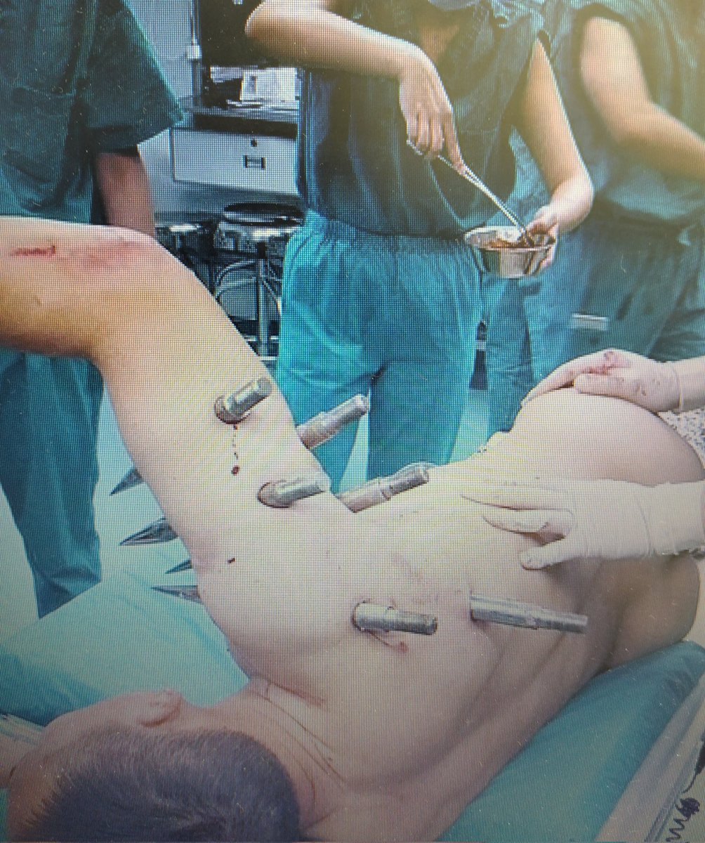 Jülyana Asanj 🇹🇷 🇪🇸 tweet media