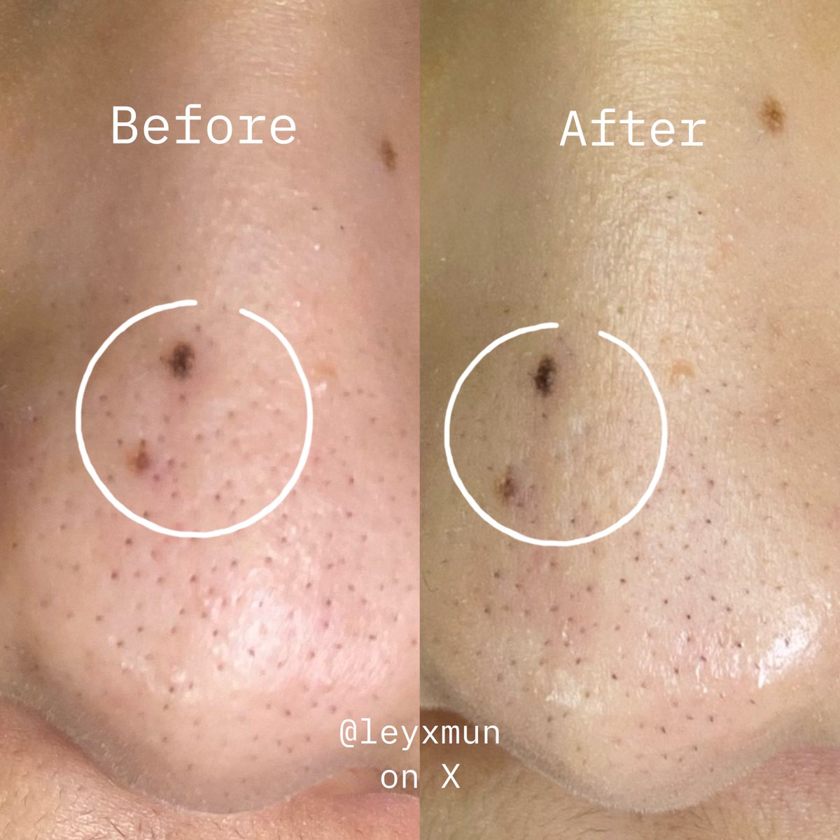 skyxbluew's tweet image. Kunci utama untuk calming jerawat dan bersihin pori-pori secara instan yaitu dengan pakai clay stick mugwort!

Under 50k aja packagingnya travel friendly dan praktis anti belepotan bisa dibawa kemanapun 🫶🏻 #DivMereview