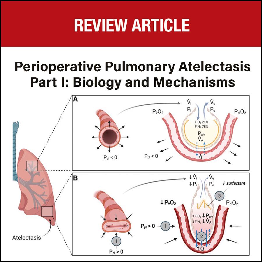 Authors review information on the pathophysiological mechanisms producing atelectasis and its functional, biologic, and biomechanical consequences. This mechanistic understanding aims to provide a solid basis for critical assessment of clinical management. ow.ly/vWe550Qlweh