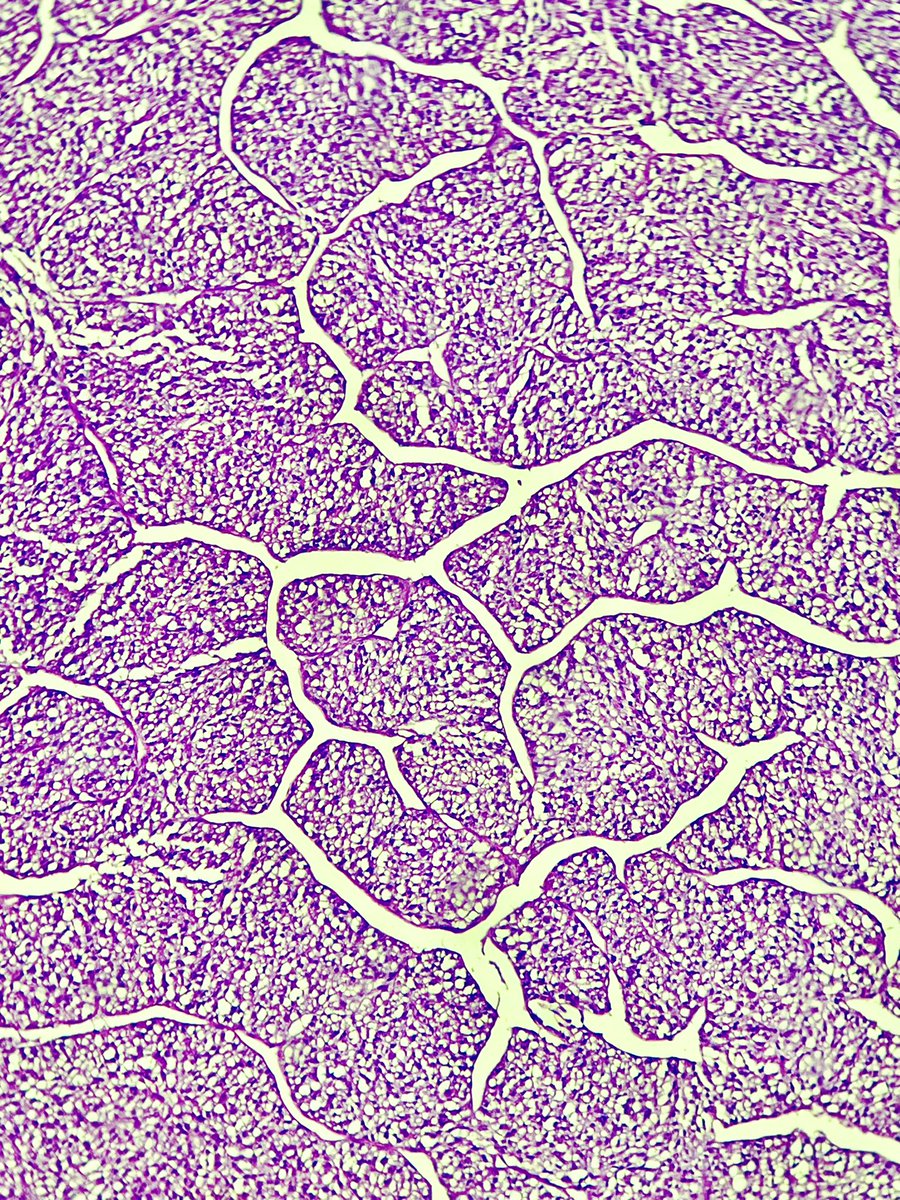 Immanuel_Paul30's tweet photo. In the mind's eye, a โfractalโ is a way of seeing the infinity !
Thoughts ?
#PathTwitter #Surgpath #impath https://t.co/r1DGrJVo4p