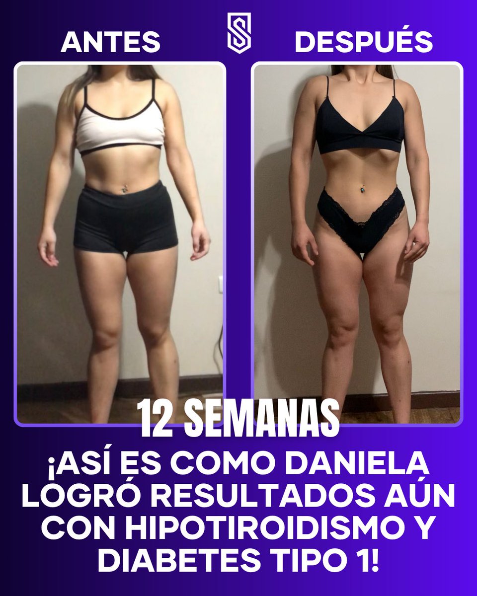 elequaz's tweet photo. ¿Alguna vez escuchaste 🗣️🗯️ ‘No puedo bajar de peso debido a X síntoma o enfermedad’? 👉Mira el caso de Daniela y reflexiona. 🤔💭 ¿Es realmente eso lo que te detiene, o quizás necesitas probar un plan de acción comprobado para obtener resultados concretos? 🤩
 
En  iG est�� todo https://t.co/RtPb7iP0aZ