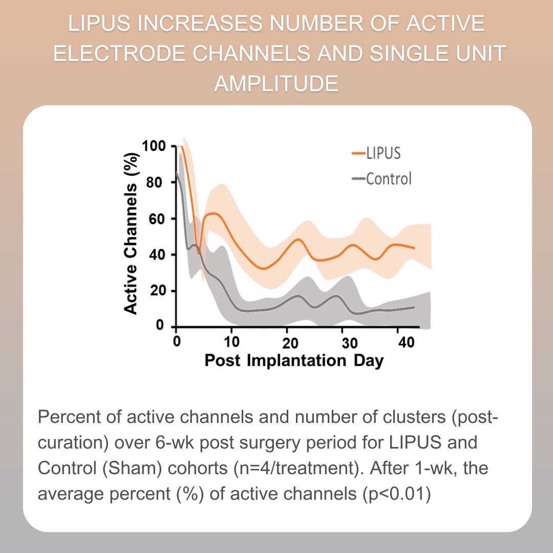 Interested in increasing your number of active channels over time? Check out our newest device, the SonoShield Defender!

actuatedneuroscience.com/sonoshield-def…