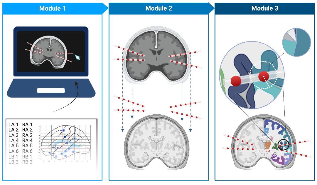 iEEG-recon: scalable fast #OpenAccess electrode reconstruction method is now in Epilepsia doi.org/10.1111/epi.17…. Validated on retrospective and prospective data in routine clinical workflow @alfrelucs @bscheid @AkashRPattnaik @e_gleich @BrianLitt2 @katedavis12341 @sandhitsu