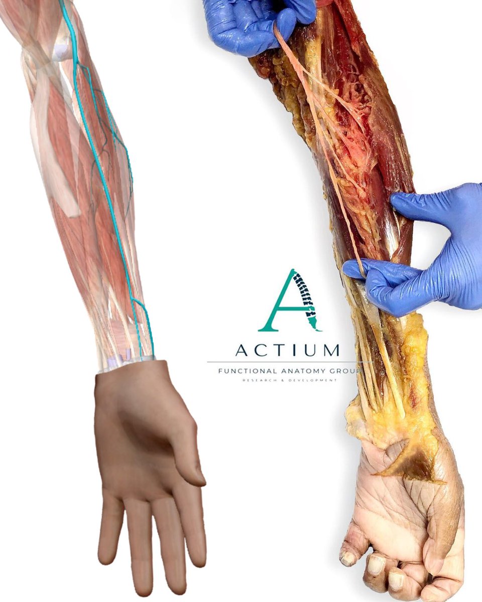 Así se ven las ramas del Nervio Radial
-
This is what the branches of the Radial Nerve look like.
-
Així es veuen les branques del Nervi Radial
.
.
.
#anatomy #MedEd #anatomia #nervio #fisioterapia #physiotherapy