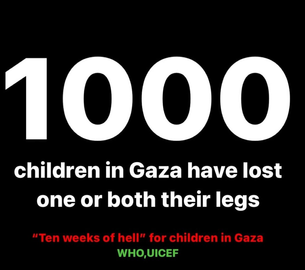 r1k_01's tweet photo. It's more than enough
Where is @UN And @amnesty
It's heartbreaking to witness the unimaginable pain that Gaza's children endure after losing their hands or legs. Every child deserves hope, healing, and a brighter future. #SupportGazaChildren #GazaGenocide #Palestine #humanity https://t.co/niiC9nENdB