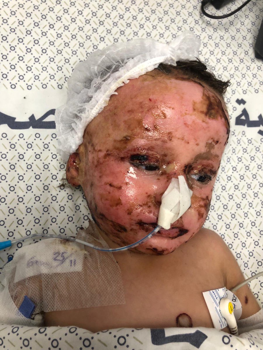 ayeshaSays___'s tweet photo. @jacksonhinkle This is 18-month-old Mesk Abu Eisha.  Her entire family were killed in an is* raeli bombing of her home, except for her father.  💔

.There are thousands of children like her in #Gaza. They’ll need a lifetime of love and help. 🇵🇸 https://t.co/D6KsIRnTJI