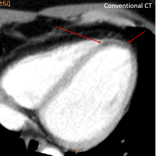 Gopal Punjabi tweet media