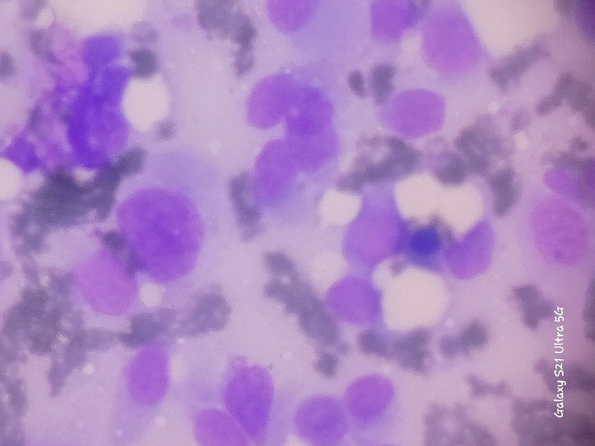 Abebaw Amare,MD tweet media