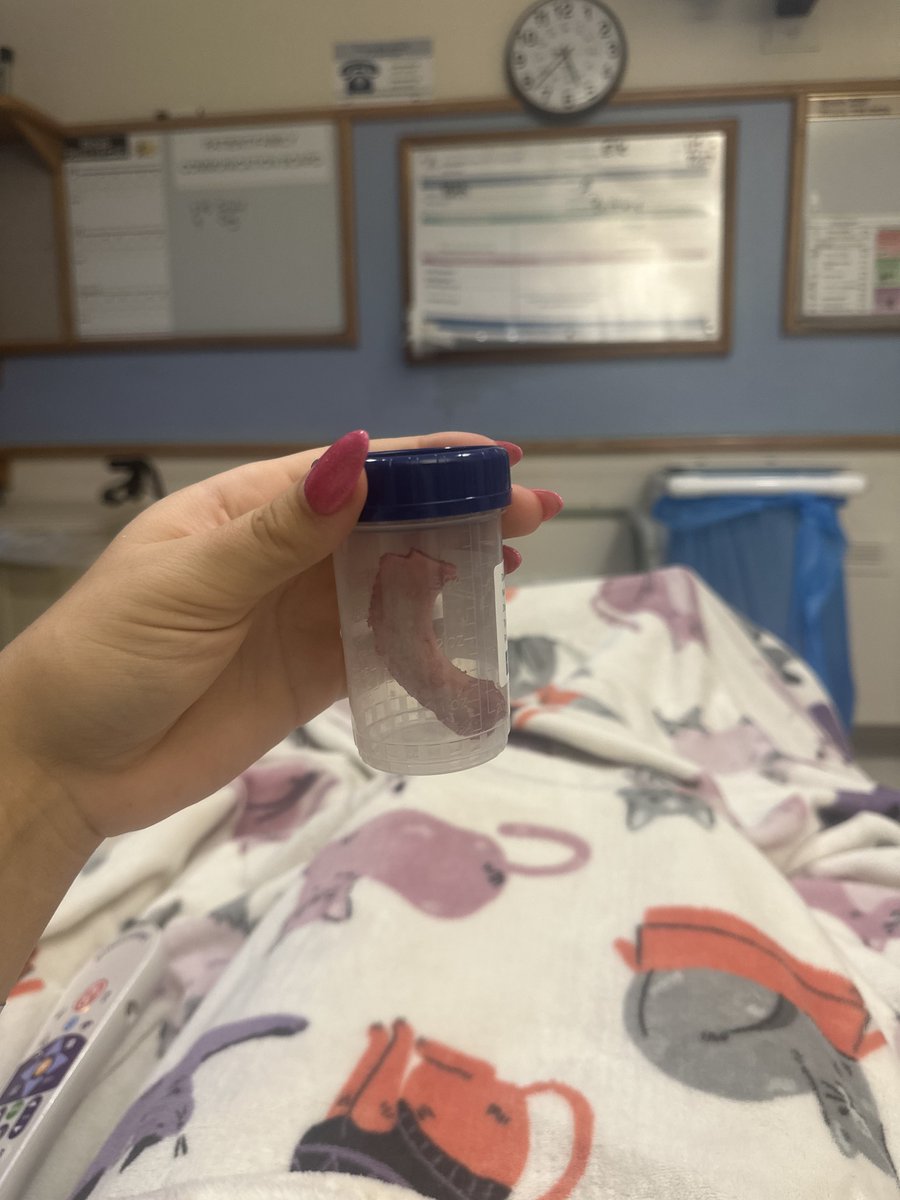 eewald13's tweet photo. Had my third and hopefully last shoulder surgery yesterday 🤞

Consisted of my first rib removal to free up the nerves and vessels being smashed between my rib and clavicle! Definitely battling a lot of pain from this procedure, although am very thankful for all the prayers ❤️❤️ https://t.co/kcUW9DzU6K