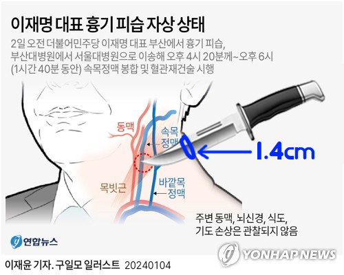 korea_gookmin's tweet photo. 이재명 대표 자상 1.4cm 가지고 조롱하는 빡대가리들아... 상처 넓이가 중요한 게 아니라 칼 깊이가 저만큼 들어간거다....

(잔인한 그림 죄송합니다 너무 잔인하면 지우겠음) https://t.co/SxnpHEv8jT