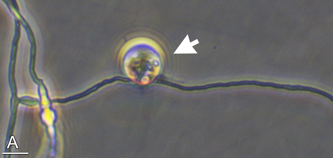 KDumack's tweet image. See for instance this #Cryptodifflugia_oviformis attached to #fungi #hyphae.