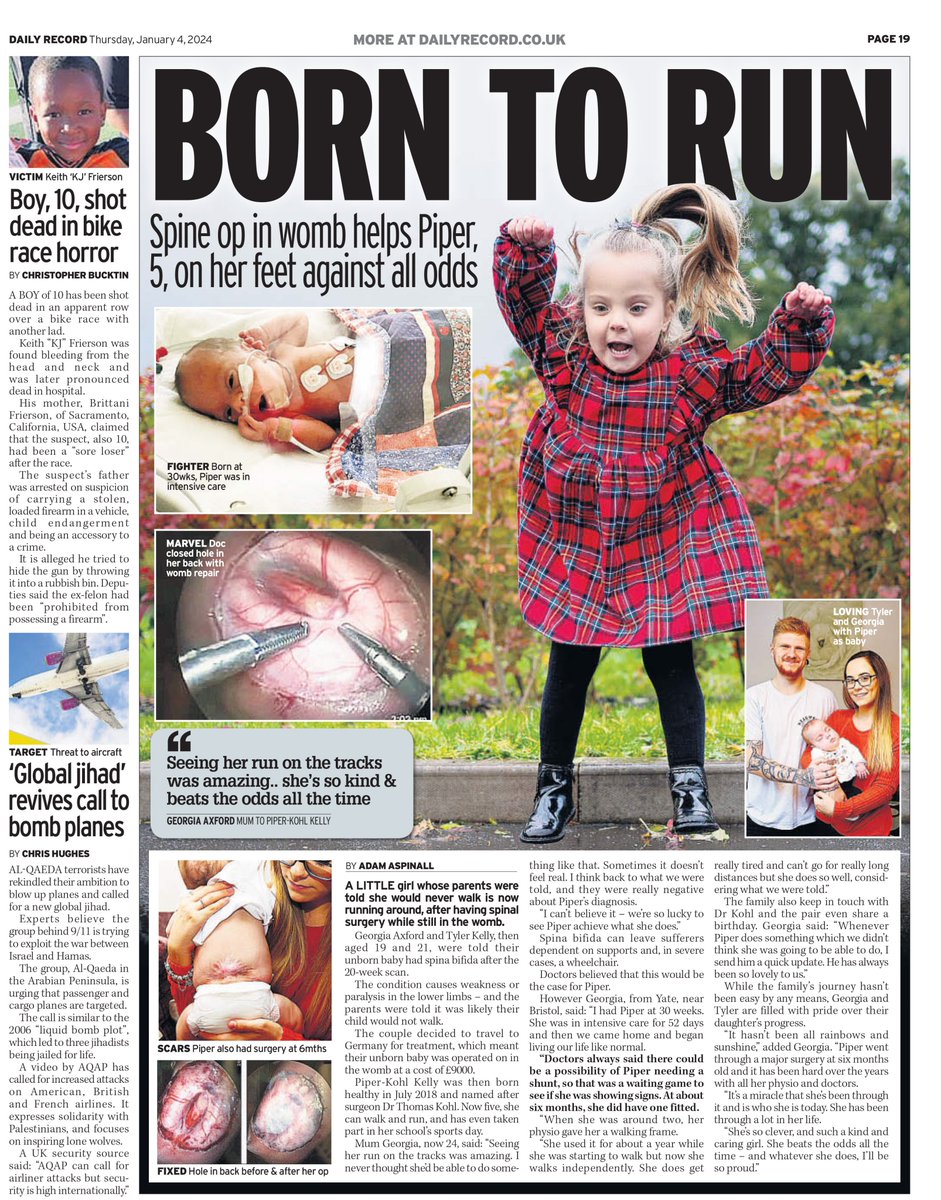 Great to see this wonderful story of a young girl who can now walk after having pioneering back surgery in the womb in some of the national papers today. @SWNS