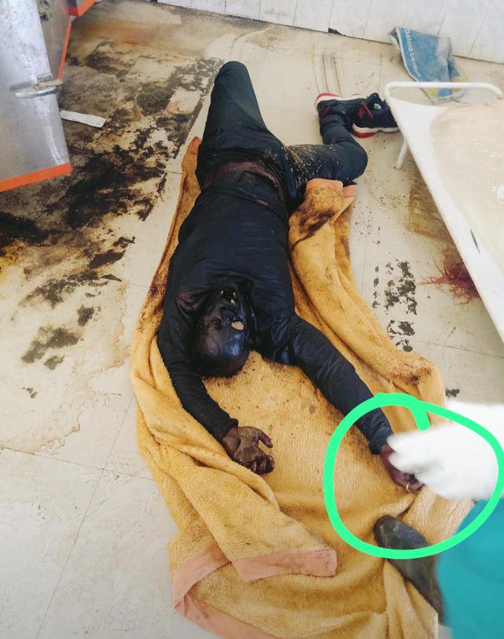 GaanKshetri's tweet photo. @tsthangkhopao The inHuman act of kuki. Eyes gouged, pouring out intestines, fingers chopped, hand broken and burnt while the heart still continues to pump.
#KukiAtrocities 
#InhumanAct
#cruelty
#Kuki_ZoDrugCommunity https://t.co/9WzkGeymJ8