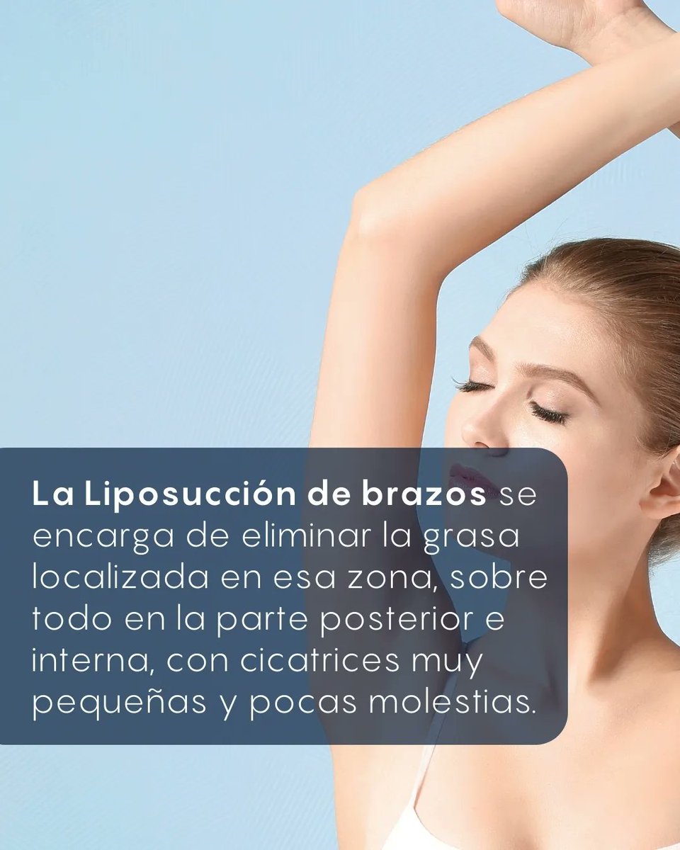 SPACPRE's tweet photo. ✅ Hoy conocé más acerca de la liposucción de brazos ☝🏻

Te recordamos la importancia de acudir a un cirujano plástico certificado ✨
 
Cuida tu vida ♥️

#lipodebrazo
#liposucciondebrazos https://t.co/A0FlKeDk7Q